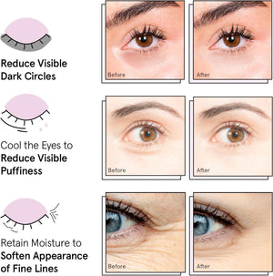 grace & stella Under Eye Masks – 24 Gold Pairs – Puffiness & Wrinkles