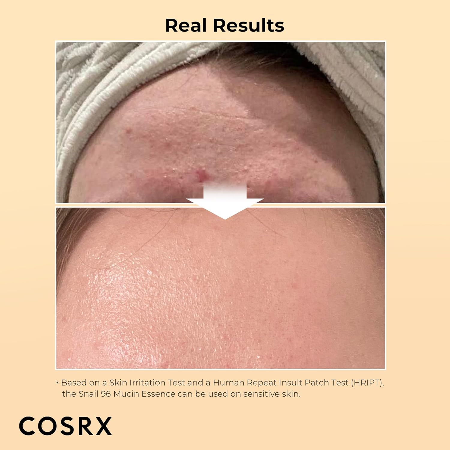 COSRX Snail Mucin Essence – 100ml – Hydrating Korean Serum for Skin