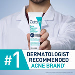CeraVe Acne Foaming Cleanser – 4% Benzoyl Peroxide, Daily Face Wash