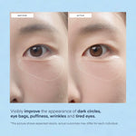Under Eye Patches – 30 Pairs – Anti-Puffiness, Dark Circles, Hydrating