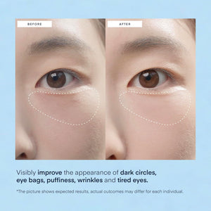 Under Eye Patches – 30 Pairs – Anti-Puffiness, Dark Circles, Hydrating
