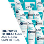 CeraVe Acne Foaming Cleanser – 4% Benzoyl Peroxide, Daily Face Wash