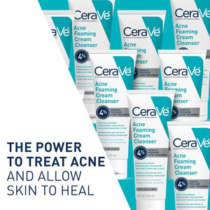 CeraVe Acne Foaming Cleanser – 4% Benzoyl Peroxide, Daily Face Wash