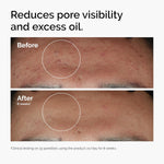 The Ordinary Niacinamide 10% + Zinc 1% – 1oz – Serum for Blemishes