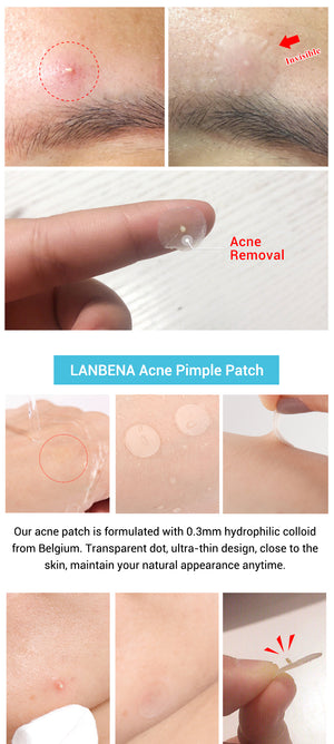 Invisible Acne Stickers