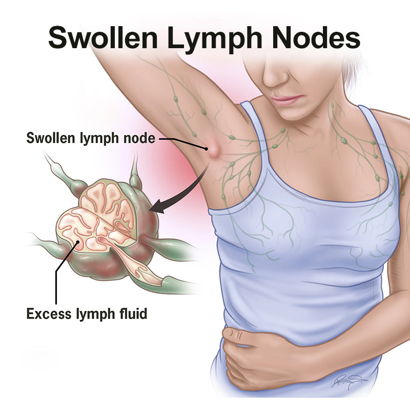 Lymphatic Detox Anti-Swelling Patch