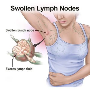 Lymphatic Detox Anti-Swelling Patch