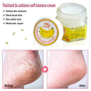 Cracked Heel Repair Cream