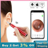 Ear Cleaning Camera